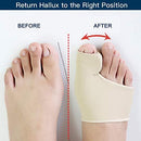 Bunion Corrector – Pain Relief & Toe Alignment