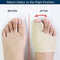 Bunion Corrector – Pain Relief & Toe Alignment