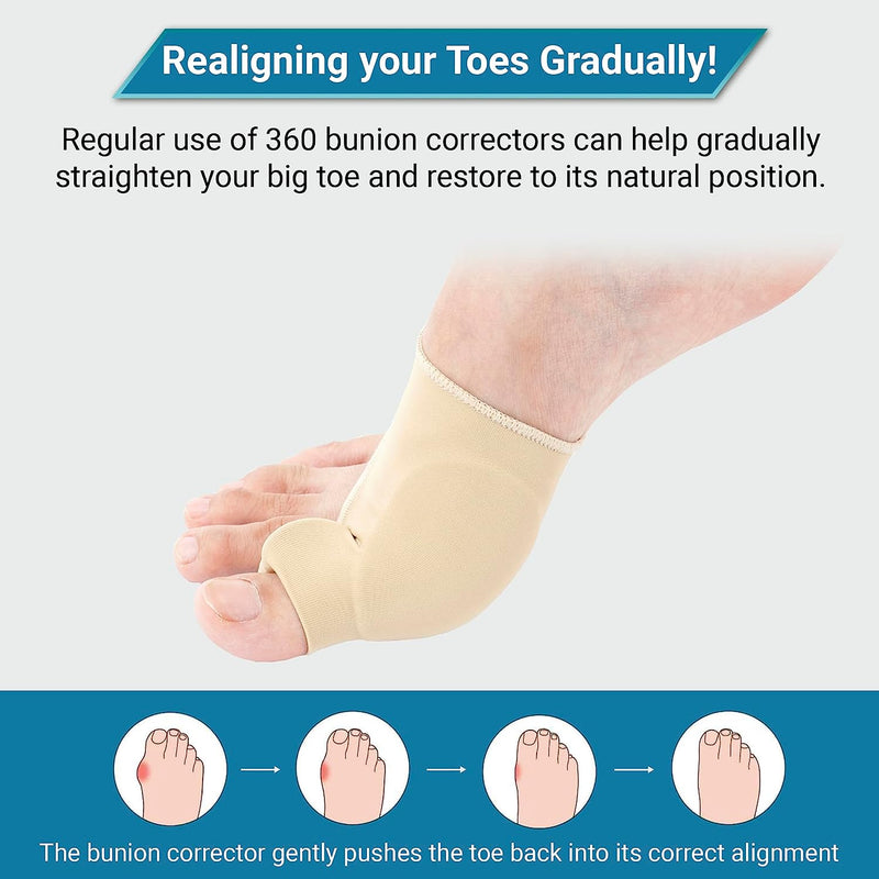 Bunion Corrector – Pain Relief & Toe Alignment