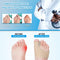 Bunion Corrector – Pain Relief & Toe Alignment